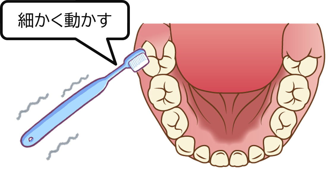 歯の王様 最大最強の６歳臼歯 東船橋の歯医者 ビバ歯科 矯正小児歯科